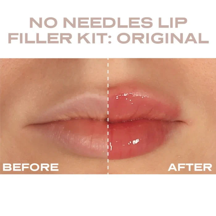 Plump It! at-home skin care kit with transparent lip filler gel in 2 x 3ml tubes for instant lip enhancement.